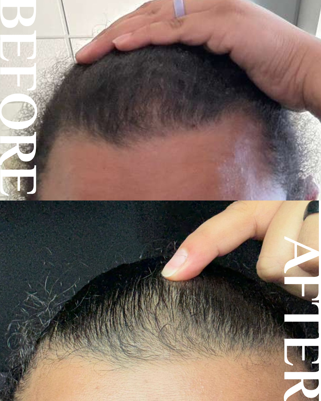 All Edges Hair Oil®