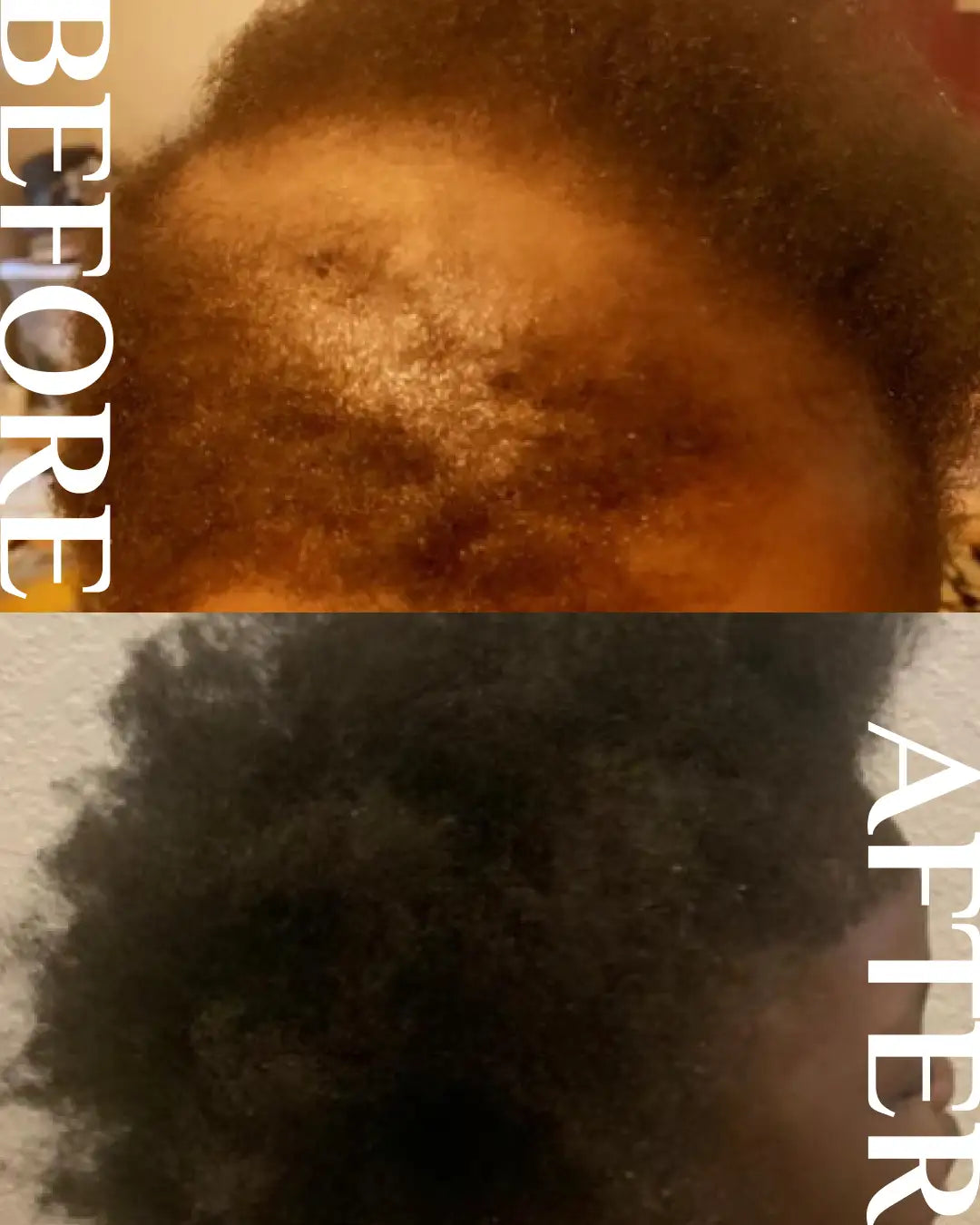 Extreme Hair Growth Oil®