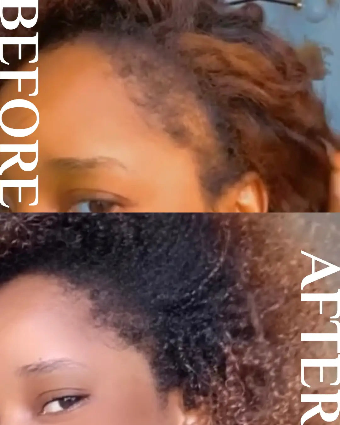Extreme Hair Growth Oil®