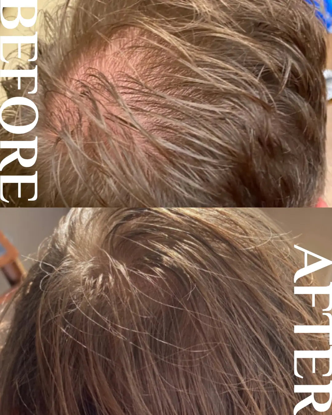 Extreme Hair Growth Oil®