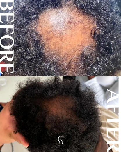 Extreme Hair Growth Oil®